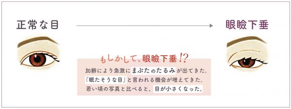 くらた医院　脱毛　美容　美肌　髪　AGA 二重手術　鼻　ヒアルロン酸　ボトックス 大分県　別府市　美容外科　美容皮膚科 美容点滴　レーザー治療　大分　しわ　たるみ　大分県　別府市　エステ　くらた医院　スキンケアラボ　メディカルエステ　エステ　エステサロン　コスメ　スキンケア　アートメイク　しみ　ホクロ　医療脱毛　美容クリニック ラセムド　美肌治療　美容液　イオン導入　大分市 眉毛 眼瞼下垂