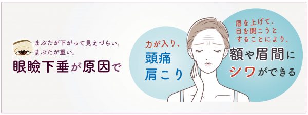 くらた医院　脱毛　美容　美肌　髪　AGA 二重手術　鼻　ヒアルロン酸　ボトックス 大分県　別府市　美容外科　美容皮膚科 美容点滴　レーザー治療　大分　しわ　たるみ　大分県　別府市　エステ　くらた医院　スキンケアラボ　メディカルエステ　エステ　エステサロン　コスメ　スキンケア　アートメイク　しみ　ホクロ　医療脱毛　美容クリニック ラセムド　美肌治療　美容液　イオン導入　大分市 眉毛 眼瞼下垂